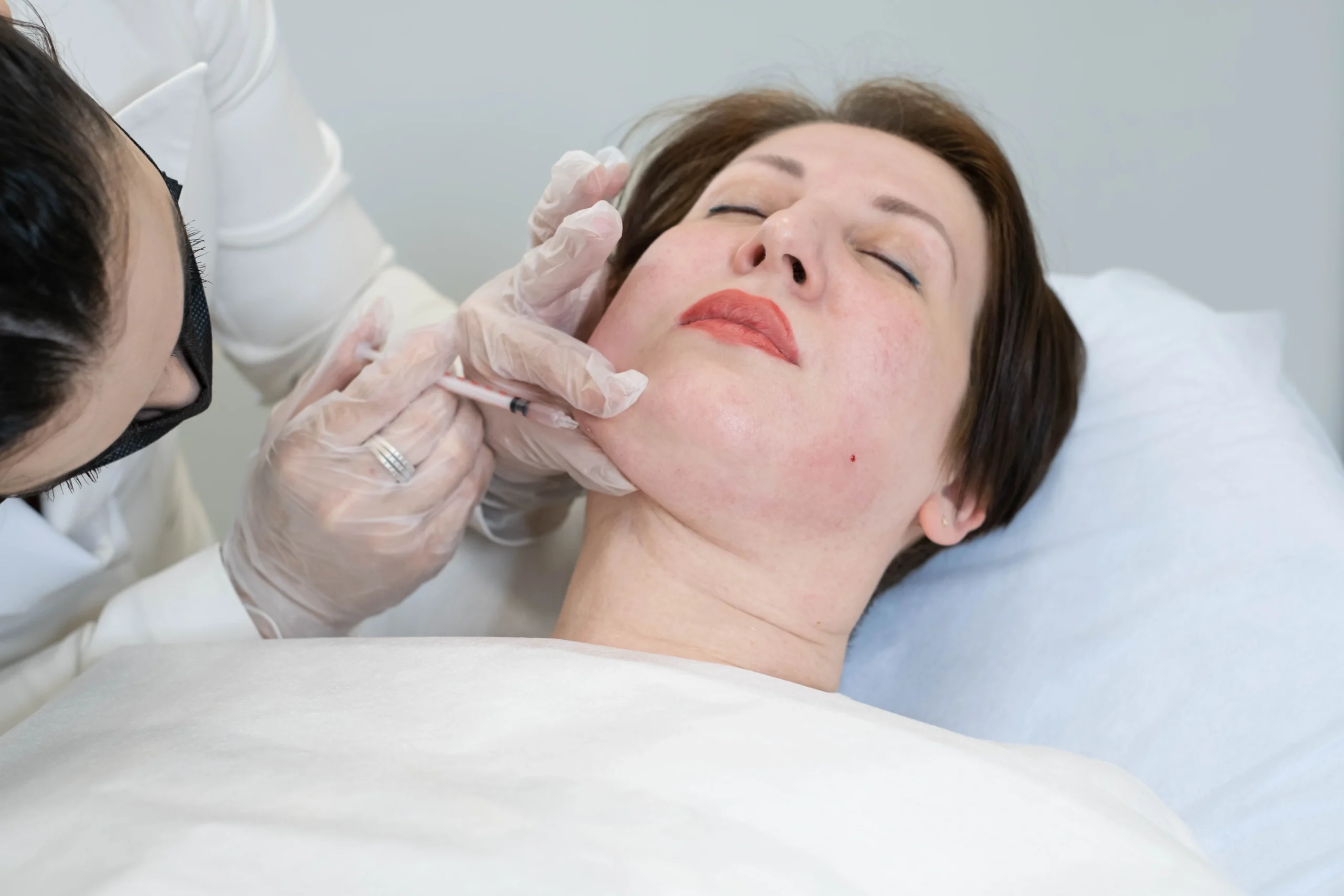 Dermal Fillers Treatment by Lakeside Aesthetics and Skincare in Horseshoe Bay, TX